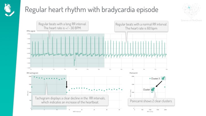 ppg visualisation graph